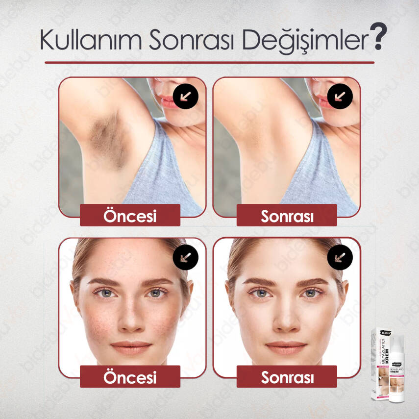 MUJGAN LEKE KARŞITI BEYAZLATICI KREM - 3
